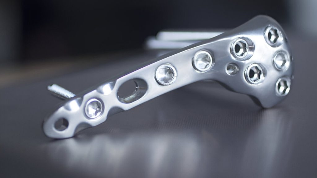 Aluminum Traumatology and Orthopedic Implant
